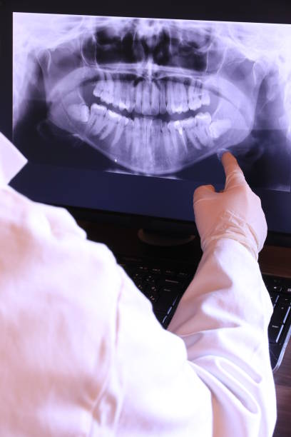 Best Emergency Cosmetic Dentistry (e.g., broken veneers) in Scott, LA