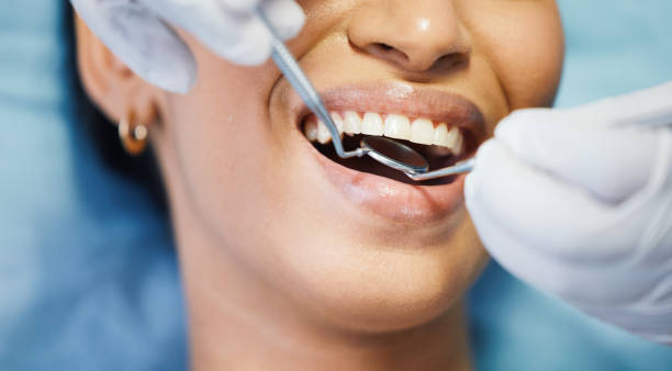 Best Lost Filling or Crown Replacement in Scott, LA