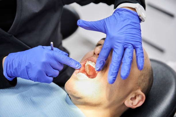 Best Emergency Care for Gum Disease in Scott, LA